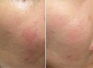 肌質改善|天王寺 For...はるかのエステ・リラクイメージ