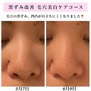 Bellesthe (ベルエステ)のエステ・リラクイメージ