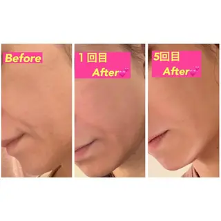 矢吹 莉菜のエステ・リラクイメージ