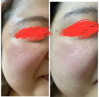 ＊Lien＊ リアンのエステ・リラクイメージ