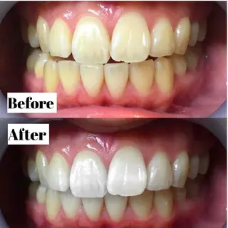 LBS吉祥寺 公式のエステ・リラクイメージ