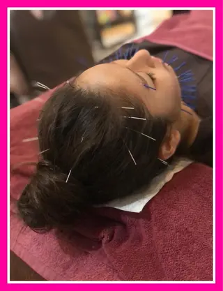 美容鍼灸女性専用 りんご鍼灸治療院のその他イメージ