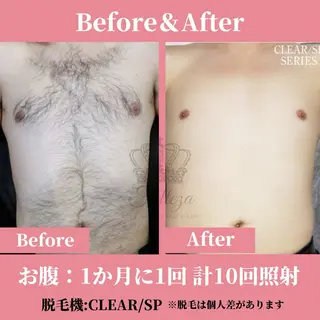 メンズ 有人型セルフサロン 脱毛/痩身/美顔のその他イメージ