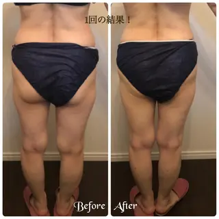 FLEUR大阪・美容 整体・痩身・小顔のエステ・リラクイメージ