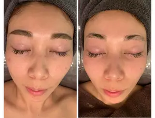 食べながら魅せボディ éclatJua川越のエステ・リラクイメージ