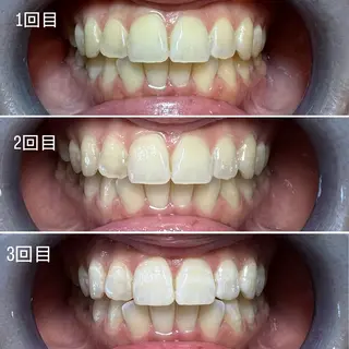 セルフホワイトニング Shineeのエステ・リラクイメージ