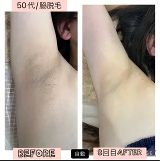 ブライダル痩身×脱毛 尼崎駅前サロンのエステ・リラクイメージ