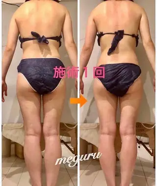 ショート カラー パーマ ヘアアレンジ メンズ キッズ ネイル マツエク・マツパ 痩身&ボディ 結果出し🌟丹野のエステ・リラクイメージ