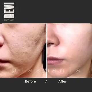 Bevi salonのその他イメージ