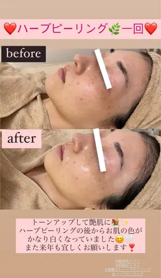 メンズ Salon de Lino 御器所のエステ・リラクイメージ