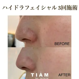 美肌サロンTIAM by tetoteのエステ・リラクイメージ