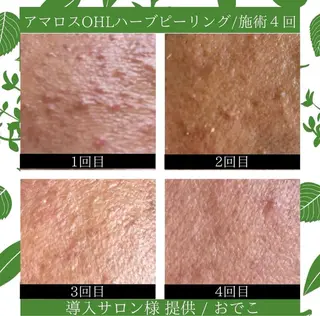 Liam《美肌管理/ 3D小顔/脂肪ケア》のその他イメージ