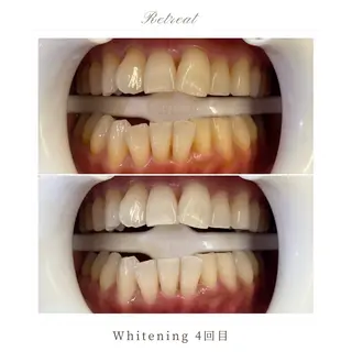 Retreatリトリート所属・歯科医院提携 Retreatのその他イメージ