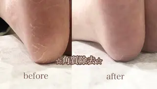 ネイル APiLA 甲斐田のネイルデザイン