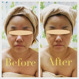 エステティック Nanagiのエステ・リラクイメージ