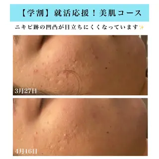 Bellesthe （ベルエステ）のエステ・リラクイメージ