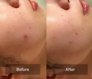 for woman所属・森 美優のエステ・リラクイメージ