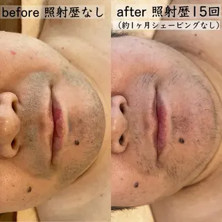 メンズ 美肌コラーゲン脱毛SINCERITE【サンセリテ】所属・瀬野 のぞみのエステ・リラクイメージ