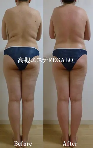 REGALO所属・矢野 さやかのエステ・リラクイメージ