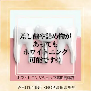 メンズ ホワイトニング ショップ高田馬場店のその他イメージ