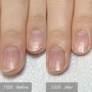 ネイル 木村 千晴のネイルデザイン