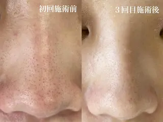 f.【エフドット】 二俣川のマツエク・マツパデザイン