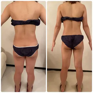 FLEUR大阪・整体 ・ハイフ・痩身・小顔のエステ・リラクイメージ