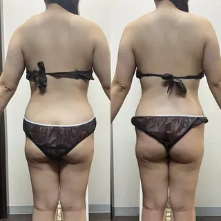 ハイパーナイフ専門店 Salon de COCO所属・Salon de COCOのエステ・リラクイメージ