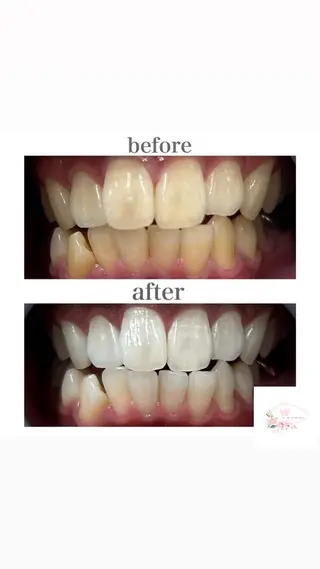 ホワイトニングショップ本厚木所属・ホワイトニング ショップ本厚木のその他イメージ