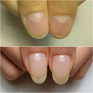 ネイル Jeliss~美爪育成ネイル＆頭蓋骨小顔矯正サロン~所属・美顔(小顔)矯正& 美爪育成Jelissのエステ・リラクイメージ