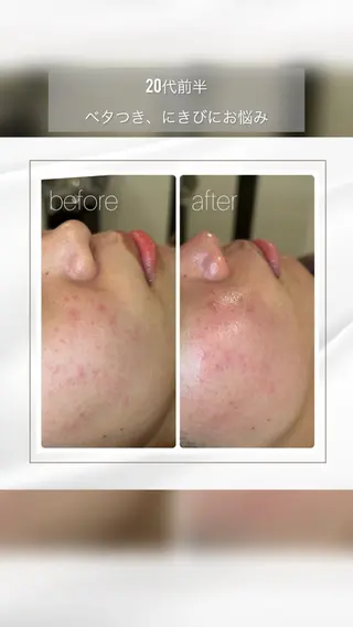 BEAUTY SALON R's所属・BEAUTY SALON R'sのエステ・リラクイメージ