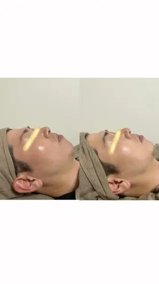 espoir所属・espoir🌿 FHR脱毛・ﾏﾂﾊﾟのエステ・リラクイメージ