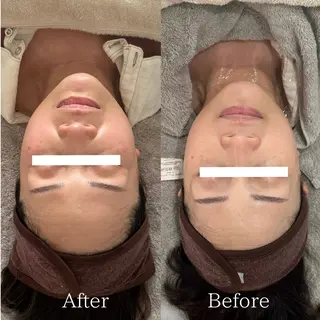 lafleur Yurinaのエステ・リラクイメージ