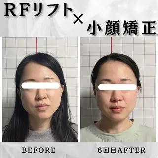 小顔矯正専門店 ❤️池田 桃花のエステ・リラクイメージ