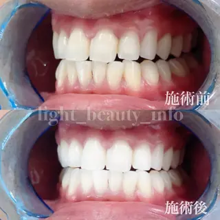 ライトビューティー 銀座本店のエステ・リラクイメージ