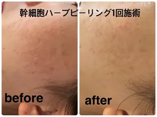 Total beauty salon Dune所属・ニキビ・肌質改善 サロンDuneのエステ・リラクイメージ