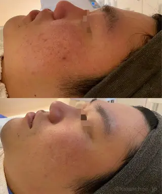 肌質改善 KALANCHOEのエステ・リラクイメージ