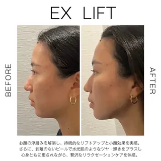 NANI OAFU所属・NANIOAFU [なんば店］のエステ・リラクイメージ