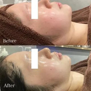 DahliaBeauty ダリアビューティー所属・DahliaBeau tyフェイシャル中村のその他イメージ