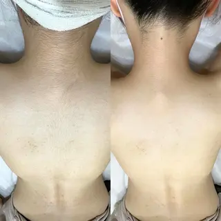 脱毛専門サロンElixir加須店所属・脱毛専門サロン Elixir　加須店のエステ・リラクイメージ