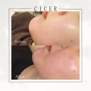 cicerよもぎ蒸し所属・cicerよもぎ蒸し ハーブピーリングのその他イメージ