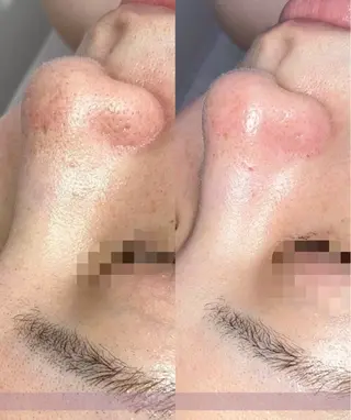 小顔専門salon miélu ミエルのエステ・リラクイメージ