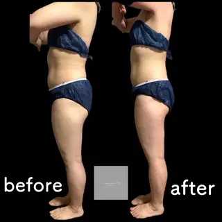 marron所属・痩身ハイパーナイフ ララピールリアボーテのエステ・リラクイメージ