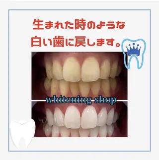 メンズ ホワイトニング ショップ船橋店のエステ・リラクイメージ