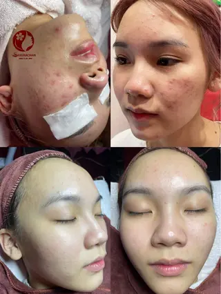 ニキビ、痩身、脱毛、 サクラチャンスパのエステ・リラクイメージ