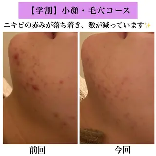 Bellesthe (ベルエステ)のエステ・リラクイメージ