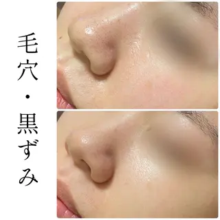 ハーブピーリング専門 BIOEL横浜のエステ・リラクイメージ