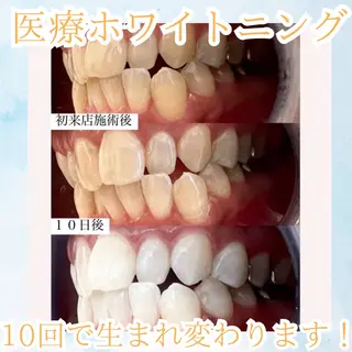 メンズ ホワイトニング専門店 WHITE天神店のエステ・リラクイメージ