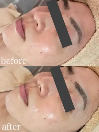 WHITE AQUA 北千住店のエステ・リラクイメージ