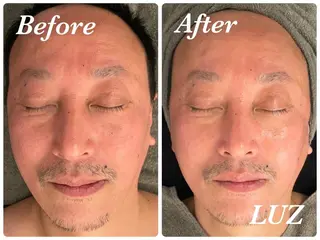 メンズ メンズフェイシャル アイブロウ・ルースのエステ・リラクイメージ